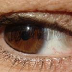 Occhio furbo: Albina